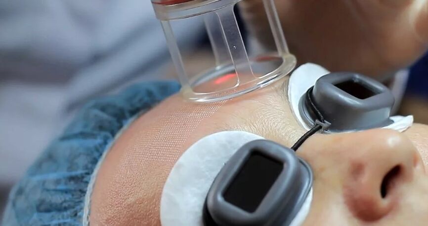 Veldlaser